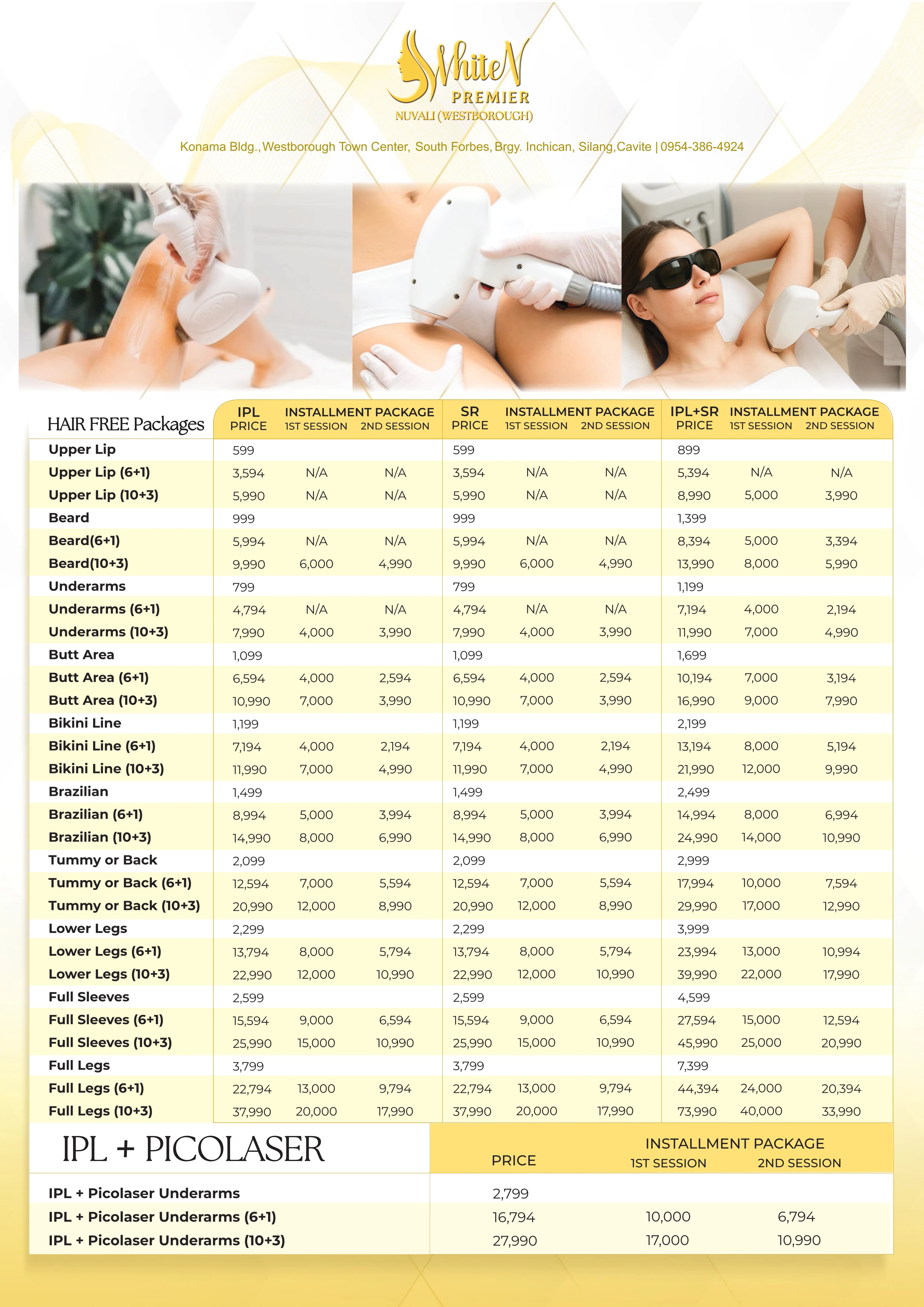 IPL — Underarms